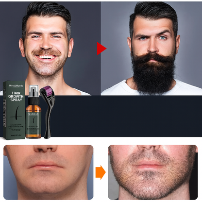 Comparatif avant-après montrant l’efficacité du kit de croissance barbe West&Month, incluant spray activateur et rouleau dermique, avec une amélioration visible de la densité de la barbe